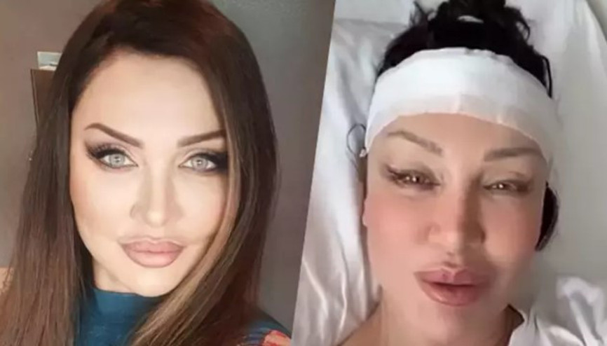 Umut Akyürek bıçak altına yattı: Alın daraltma ameliyatı geçirdim Umut Akyürek bıçak altına yattı: Alın daraltma ameliyatı geçirdim