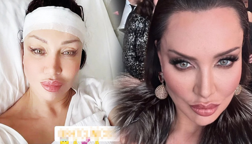 Umut Akyürek estetiğiyle şaşırttı: Geniş bir alnım vardı