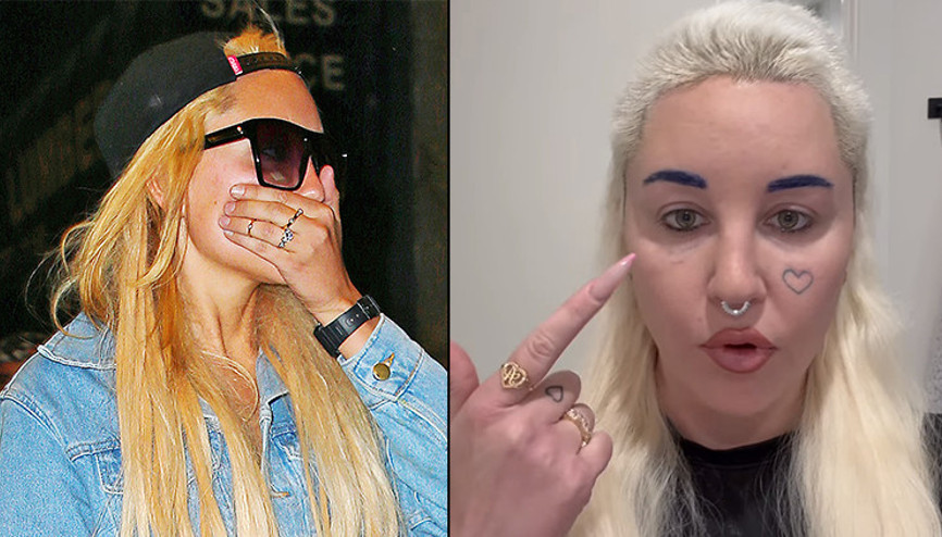 Şöhret ağır geldi… Bir zamanların yıldız oyuncusu akıl hastanesine bile yatmıştı: Estetik olup kendini baştan yarattı