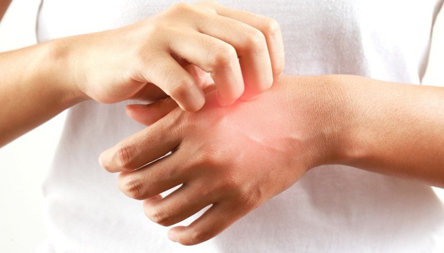 Sıtma hastalığı nedir, nasıl olur, bulaşıcı mı İşte sıtma hastalığı belirtileri ve tedavisi