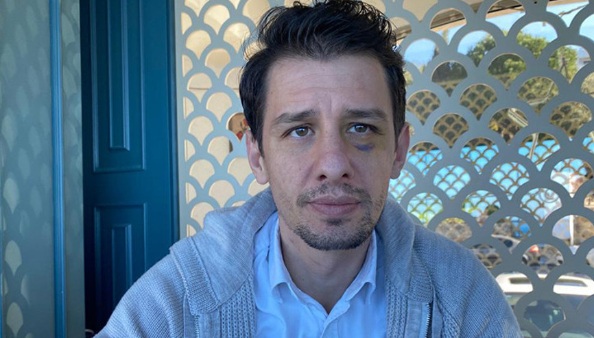 Hakem Halil Umut Meler, çirkin saldırı sonrası her şeyi açık açık anlattı: Emre Belözoğlu planladı, provoke etti | Bu psikolojide Süper Kupayı yönetemem | Dönüşüme ailem karar verecek