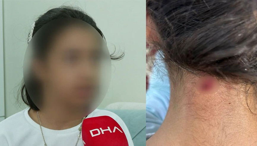 11 yaşındaki kızın boynuna maganda kurşunu isabet etti: Felç kalmaması mucize oldu