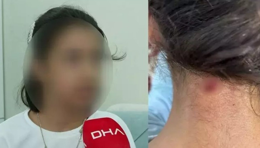Bahçelievlerde maganda kurşunu, 11 yaşındaki İremin boynuna isabet etti