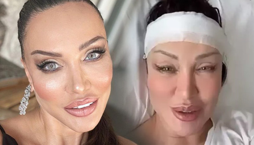 Alın daraltma ameliyatı olmuştu... Son halini paylaştı