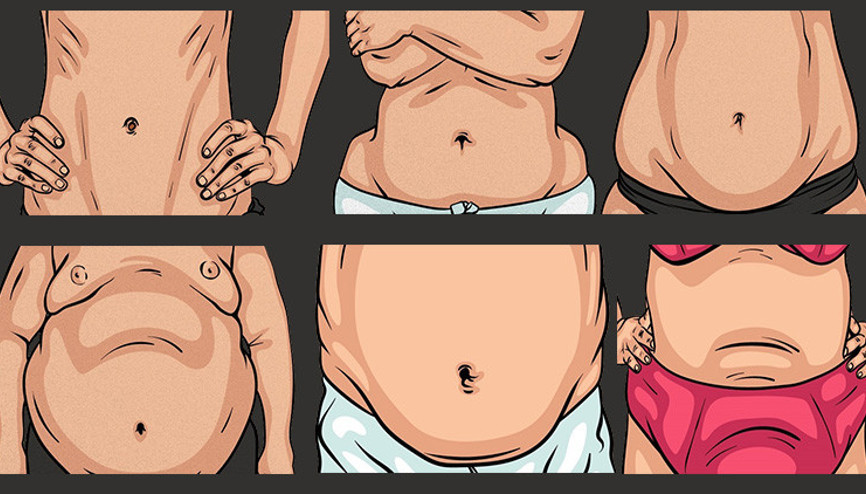 Göbek yağınız sağlığınız hakkında ne söylüyor Vücuttaki yağ oranı nasıl olmalı ‘Kadınlarda bazı kanser türlerinin habercisi olabilir’ Göbek yağınız sağlığınız hakkında ne söylüyor Vücuttaki yağ oranı nasıl olmalı ‘Kadınlarda bazı kanser türlerinin habercisi olabilir’