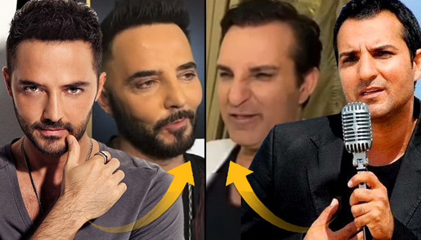 Onlar da estetik modasına uydu... Karizmam ve yakışıklılığım resmen mahvoldu