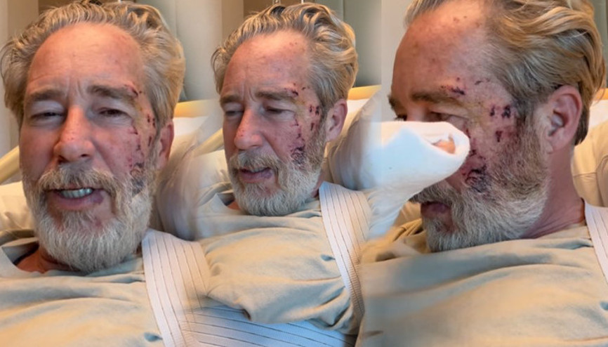 Oyuncu Sinan Albayrak çekimde kaza geçirdi