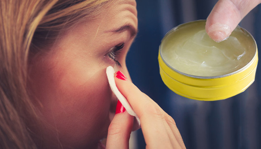 Sosyal medyada şimdi de göz kenarlarına vazelin sürmek trend oldu… ‘Kist, arpacık, enfeksiyon ve hatta görme bulanıklığına neden oluyor’ | 6 SORU 6 YANIT