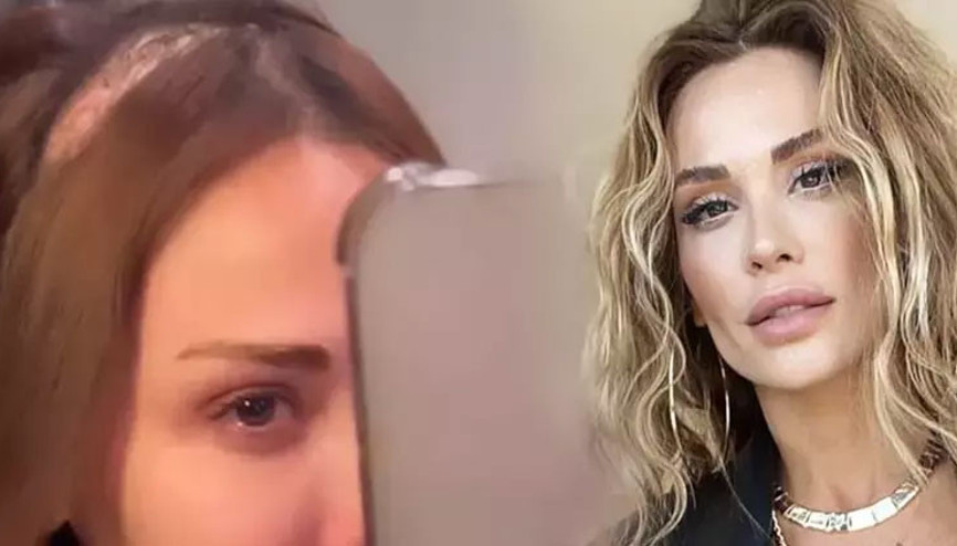 Beyin tümörü ile mücadele eden Şimal, yaşadığı zorlukları gözyaşlarıyla paylaştı