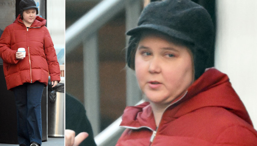 Herkes ünlü yıldızın yüzüyle alay etmişti: Altından ciddi bir hastalık çıktı