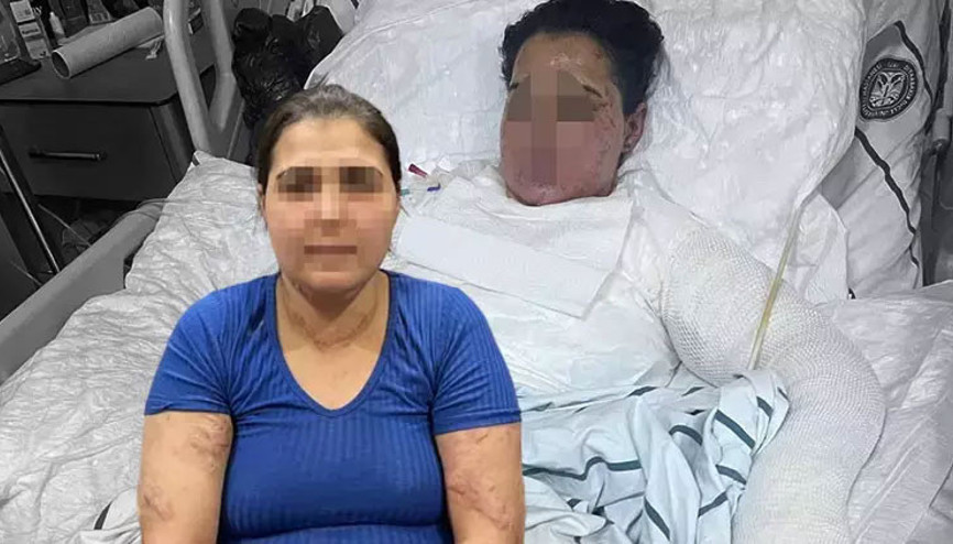 Eşinin ve kayınbiraderinin sıcak ütü basıp, kolonyayla yakmaya çalıştığı Yazgül: Beni öldürecekler Eşinin ve kayınbiraderinin sıcak ütü basıp, kolonyayla yakmaya çalıştığı Yazgül: Beni öldürecekler