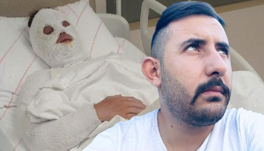 Eski nişanlısının yüzüne kimyasal atmıştı... 15 yıllık hapis kararı bozuldu
