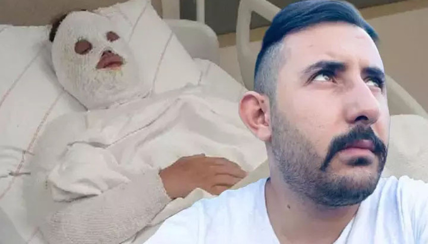 Eski nişanlısının yüzüne kimyasal atmıştı... 15 yıllık hapis kararı bozuldu