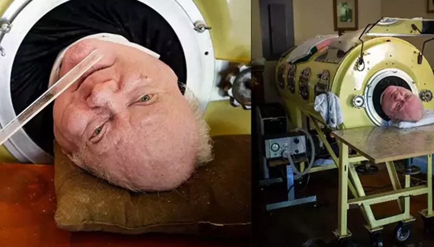 72 yılını metal kapsül içinde geçirdi Polio Paul hayatını kaybetti