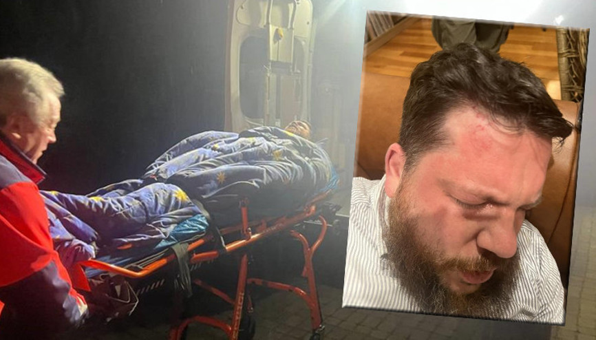 Navalninin yardımcısına çekiçli saldırı