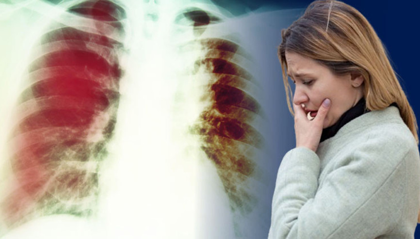 En ölümcül hastalık sessizce yayılıyor Testler negatif çıkmasına rağmen insanlar enfeksiyonu taşıyor…