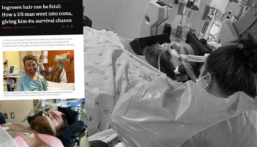 Bacağındaki kılları almaya çalışırken canından oluyordu Günlerce komada kaldı, doktorlar yaşaması için yüzde 4 şans verdi