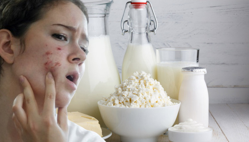 Süt ürünleri sivilce yapar mı Sivilcelerinizin sorumlusu tükettiğiniz süt ürünleri olabilir mi Araştırmalar ne diyor Süt ürünleri sivilce yapar mı Sivilcelerinizin sorumlusu tükettiğiniz süt ürünleri olabilir mi Araştırmalar ne diyor