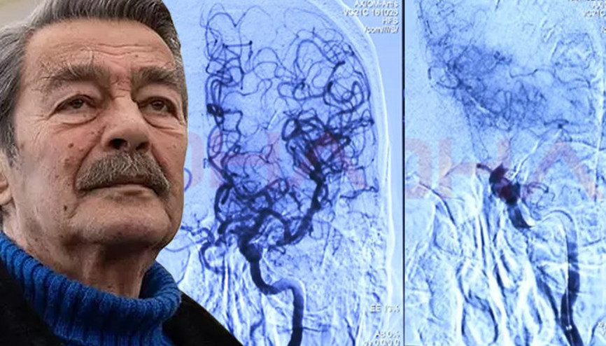 Kadir İnanır’ın hayatını kurtaran detay