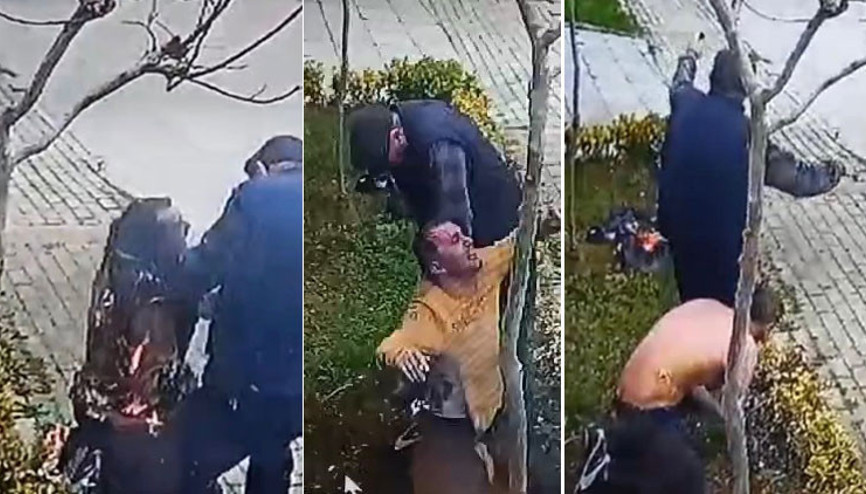 Villa yangınında cinayet şüphesi Soruşturmada dikkat çeken detay: Yaralı bahçıvan alevler içinden böyle çıktı Villa yangınında cinayet şüphesi Soruşturmada dikkat çeken detay: Yaralı bahçıvan alevler içinden böyle çıktı
