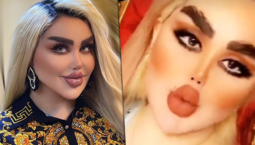 Iraklı Barbie 43 estetik ameliyat geçirdi, insanlar zombiye benzediğini söylüyor