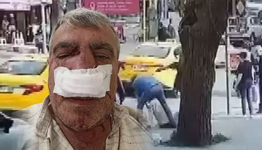 Taksici, aracına vuran yayanın burnunu kırdı O anlar kamerada