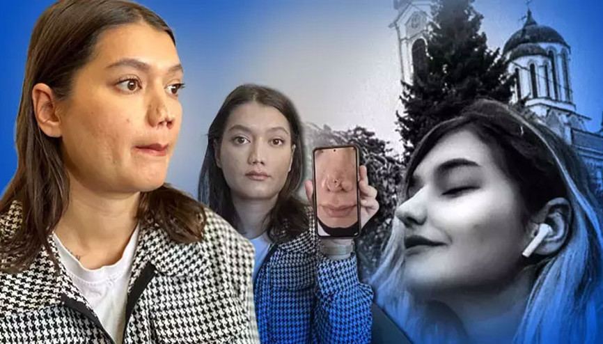 Ameliyatta burun estetiğinin bozulduğu iddiasıyla 1 milyon liralık tazminat davası açtı