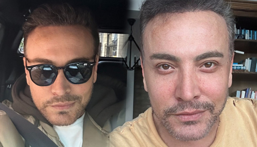 Estetik operasyonunun ardından Cenk Erene nazar değdi