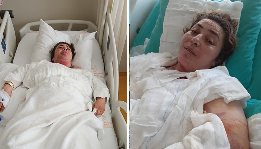 46 yaşındaki kadın mutfakta kâbusu yaşadı Bomba gibi patladı... Yüzüme gelse kurtulamazdım