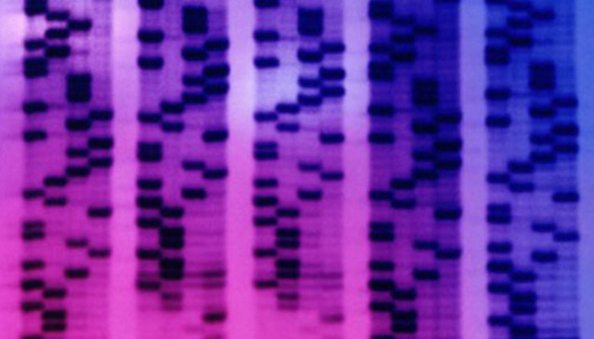 Prostat kanserini erken teşhis edebilen tükürük testi