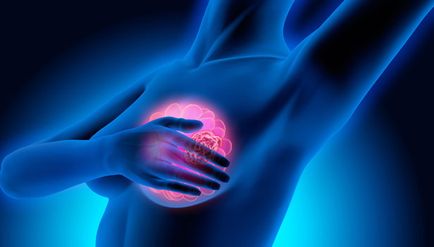 20li yaşlarının başında meme kanseri olduğunu öğrendi, altı tur kemoterapi aldı ama iyileşemedi