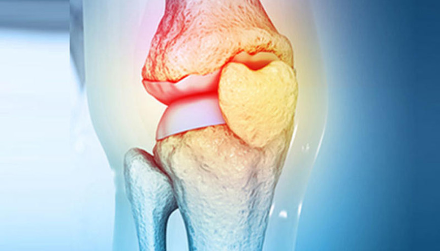 Uzmanından kemik kaybını geciktirecek öneriler... 25-30 yaşları arasına dikkat