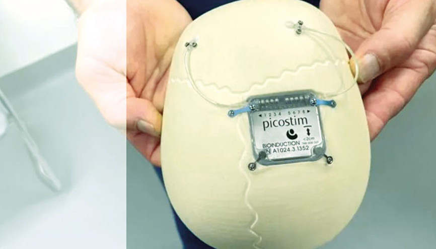 Dünyada ilk kez denendi: Kafatasına epilepsi cihazı yerleştirildi