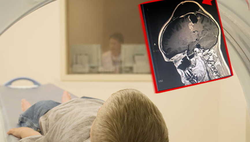 Baş ağrısı, kalp çarpıntısı ve panik atak yaşamaya başladı Doktorlar telefonu daha az kullanmasını söyledi… Sekiz ay sonra ise beyninde tümör olduğu ortaya çıktı Baş ağrısı, kalp çarpıntısı ve panik atak yaşamaya başladı Doktorlar telefonu daha az kullanmasını söyledi… Sekiz ay sonra ise beyninde tümör olduğu ortaya çıktı