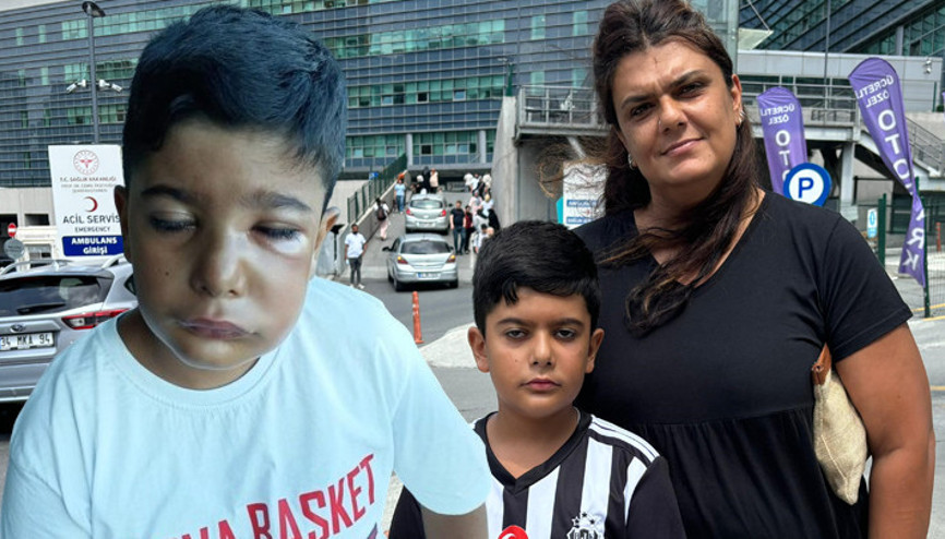 Enfeksiyonlu dişi çekilen 8 yaşındaki çocuk, kâbusu yaşadı Yüzü şişti, gözleri kapandı