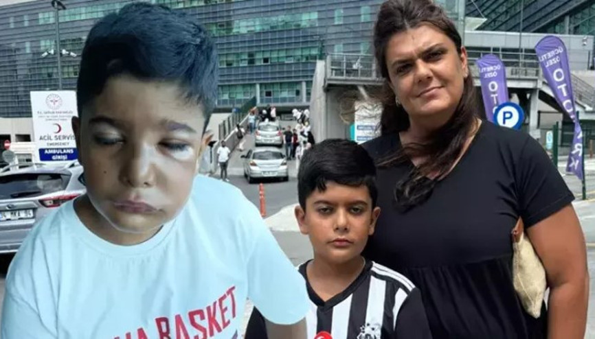 Enfeksiyonlu dişi çekilen 8 yaşındaki çocuk az kalsın gözünden oluyordu