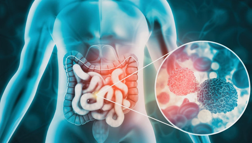 Her gün 100 gence teşhis konuyor... Bu hastalık artık her yaşta çok sık görülüyor