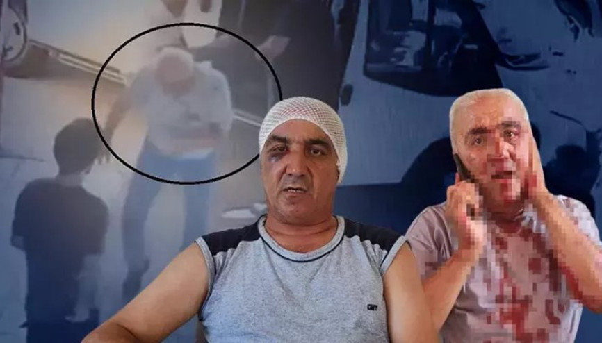 Hatayda minibüs şoförünü 9 yerinden ısırıp kulağını kopardı...Olay anı kamerada