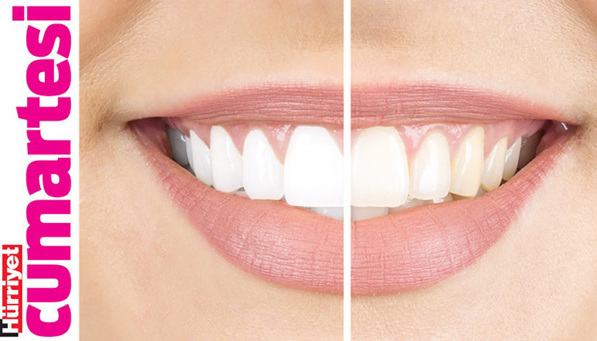 Hap macun, diş mendili, ağız duşu...