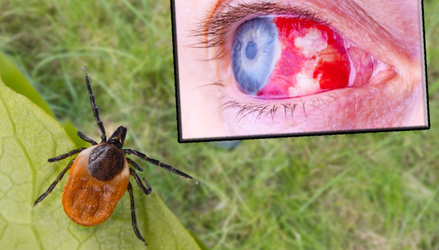 Burun ve gözlerde ölümcül kanamaya neden olan bu virüs can alıyor