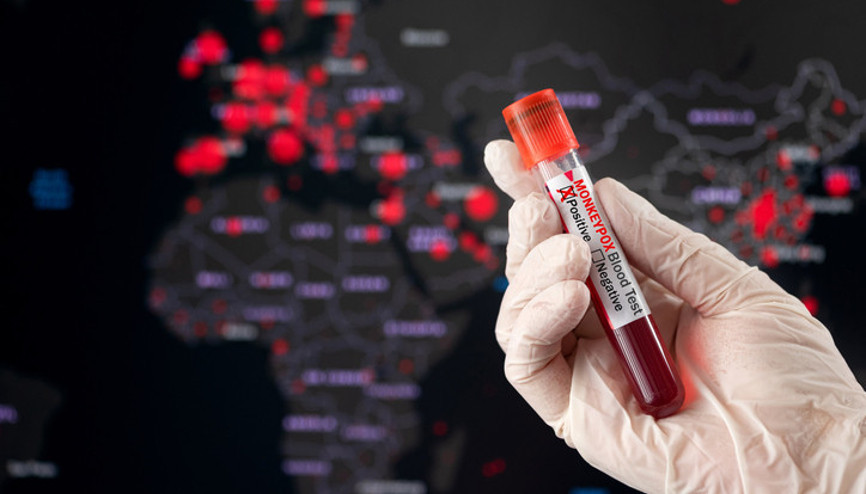 Maymun çiçeği Türkiyede görüldü mü 28 Ağustos son durum || Maymun çiçeği hastalığı ölümcül mü