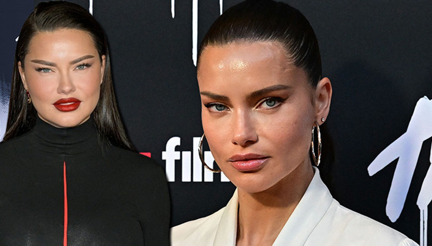 Yüzü tanınmayacak hale gelmişti… Ünlü modeli gören şaşkına döndü: Eski Adriana’mız geri dönmüş Yüzü tanınmayacak hale gelmişti… Ünlü modeli gören şaşkına döndü: Eski Adriana’mız geri dönmüş