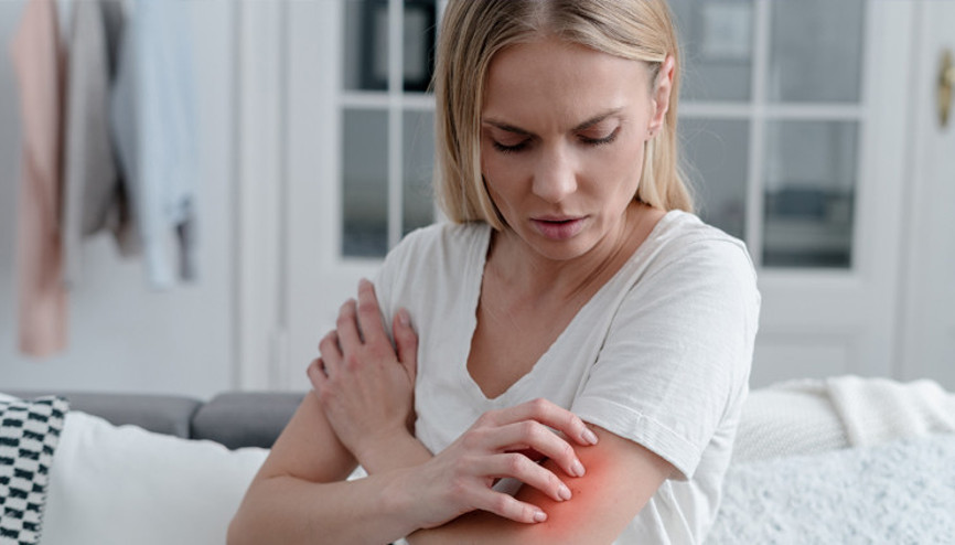 Atopik dermatit sayısı hızla artıyor... Uzun soluklu kronik ama bulaşıcı değil Atopik dermatit sayısı hızla artıyor... Uzun soluklu kronik ama bulaşıcı değil