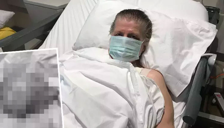 Göğsünden boynuna kadar uzanan 7 kiloluk kitleyi taşıyan Özcan’ın tümörü temizlendi