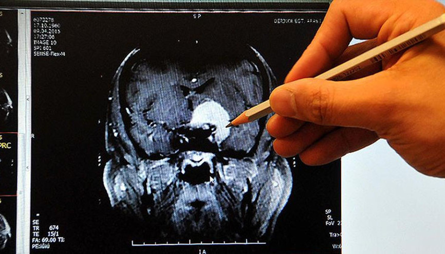 Kahve severler dikkat Zararları ortaya çıktı... Günde 3 bardağa kadar... Kahve severler dikkat Zararları ortaya çıktı... Günde 3 bardağa kadar...