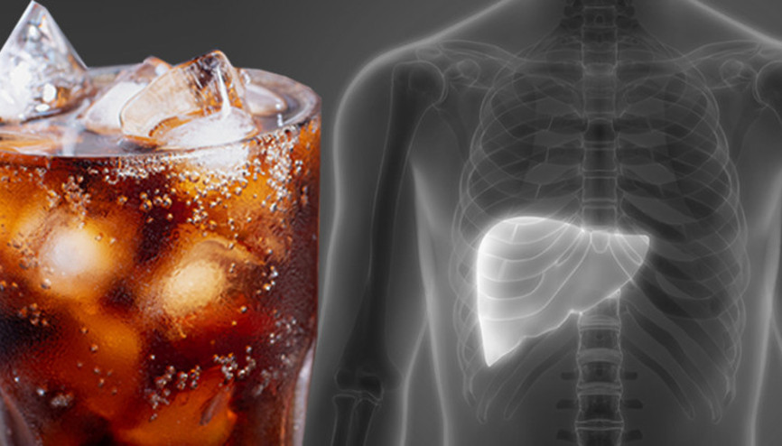 O kadar çok gazlı içecek tüketti ki en sonunda karaciğer nakli olmak zorunda kaldı… Üstelik alkol almıyordu, obez değildi ve spor yapıyordu ‘Benim gibi uyarı işaretlerini sakın görmezden gelmeyin’