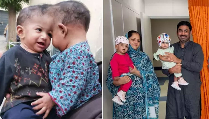 Türkiyede bu ameliyat ilk kez yapıldı