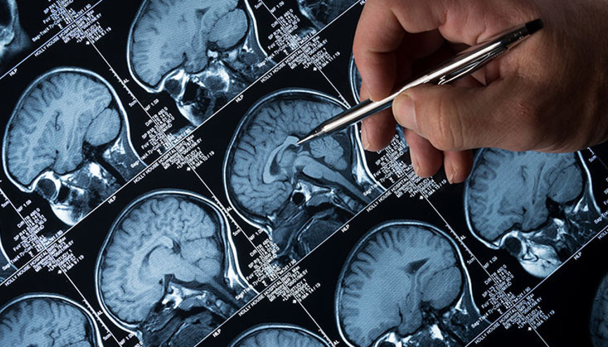 12 yaşındaki kıza tümör teşhisi konuldu: İlk işareti gözlerinde görüldü