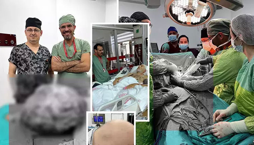 Erkek hastanın karnından 26 kiloluk tümör çıkaran cerrah: Böyle bir kitleyi literatürde hiç göremedim