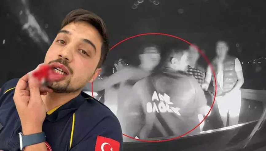 Baba ile oğlunun saldırısına uğrayan paramedik ambulans sürücüsü, olay anını DHA’ya anlattı Baba ile oğlunun saldırısına uğrayan paramedik ambulans sürücüsü, olay anını DHA’ya anlattı
